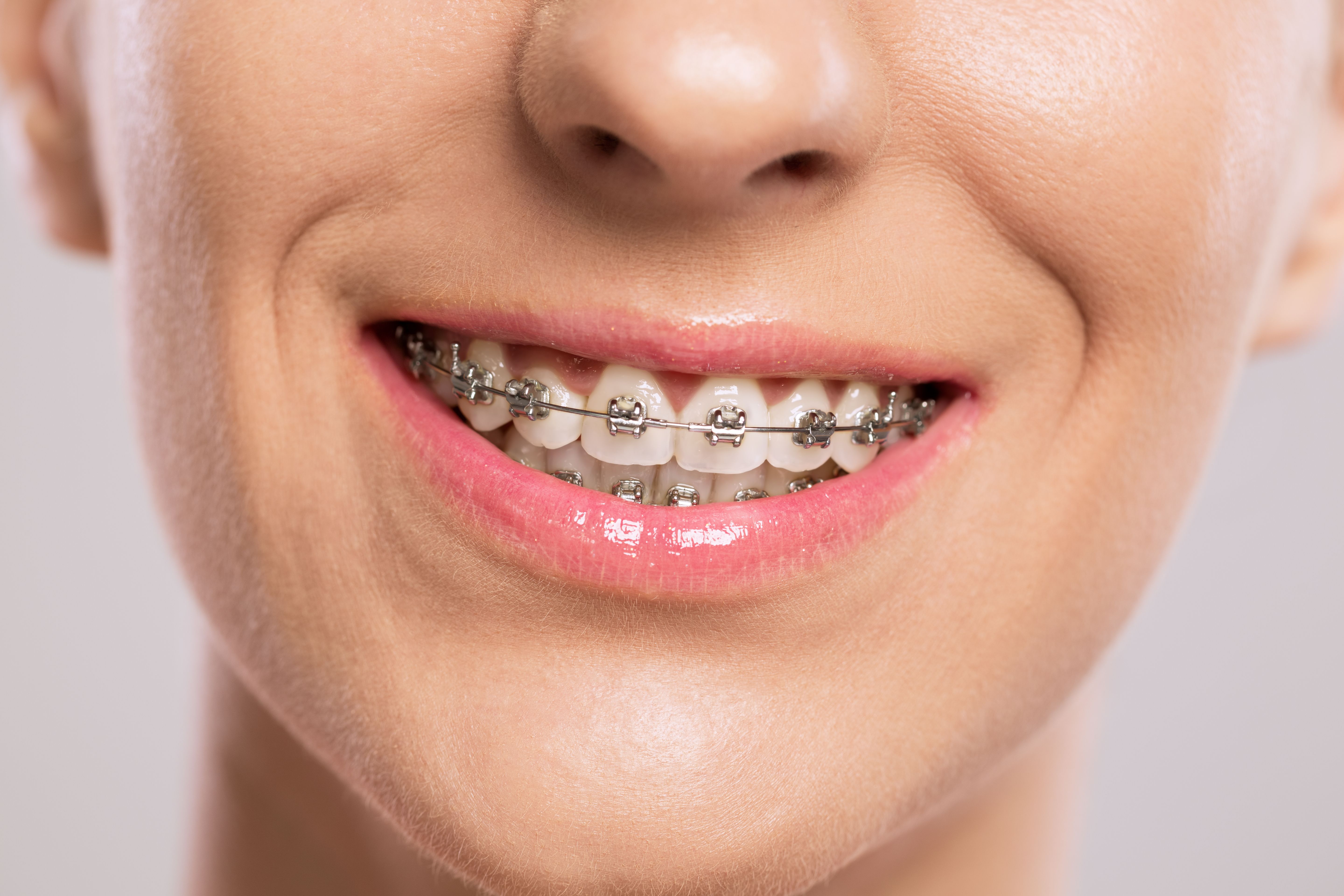 Ortodoncia: Tratamientos dentales de Clínica Dental Álvaro Gómez Ortodoncia: Tratamientos dentales de Clínica Dental Álvaro Gómez