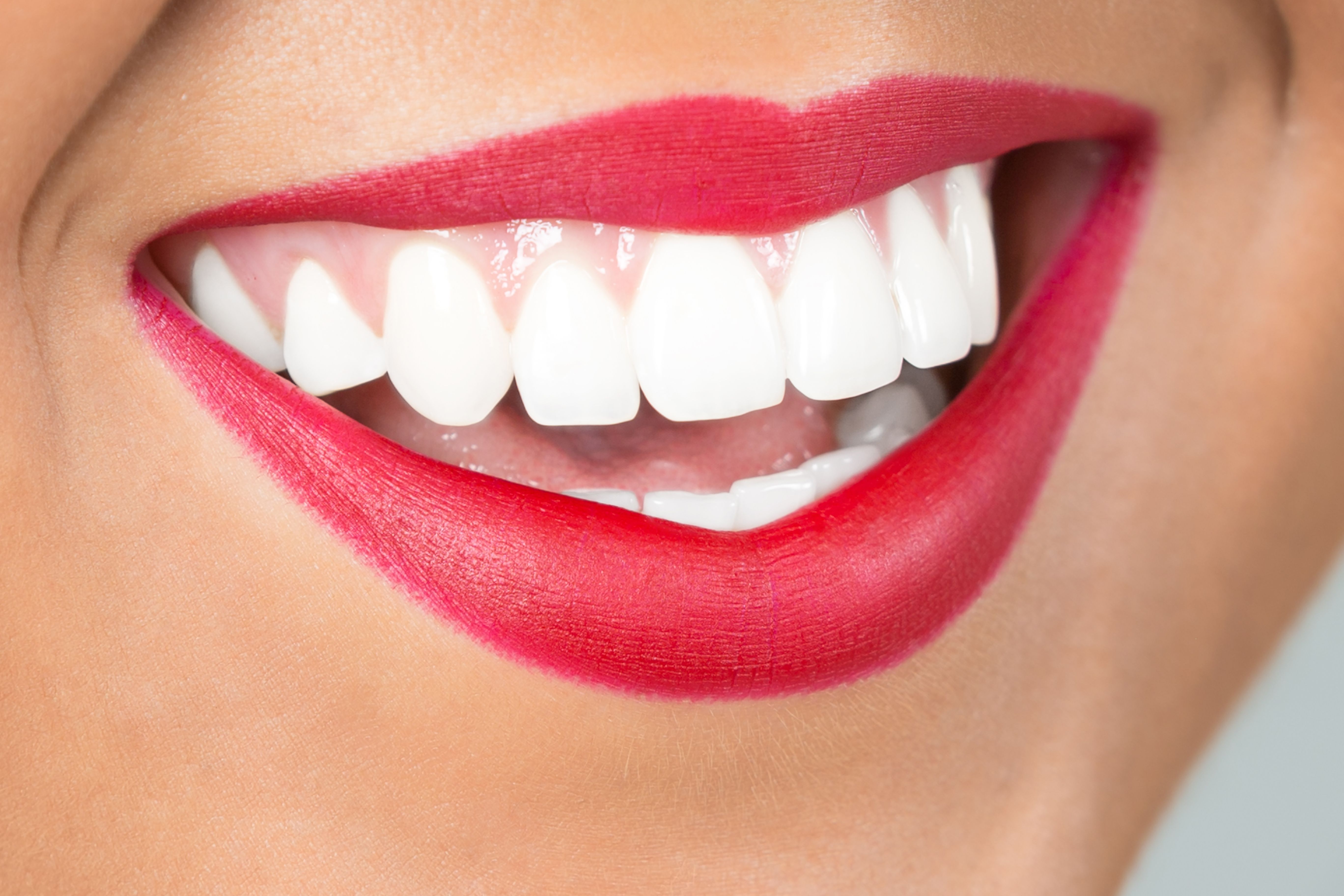 Philips Zoom. Blanqueamiento profesional: Tratamientos dentales de Clínica Dental Álvaro Gómez Philips Zoom. Blanqueamiento profesional: Tratamientos dentales de Clínica Dental Álvaro Gómez