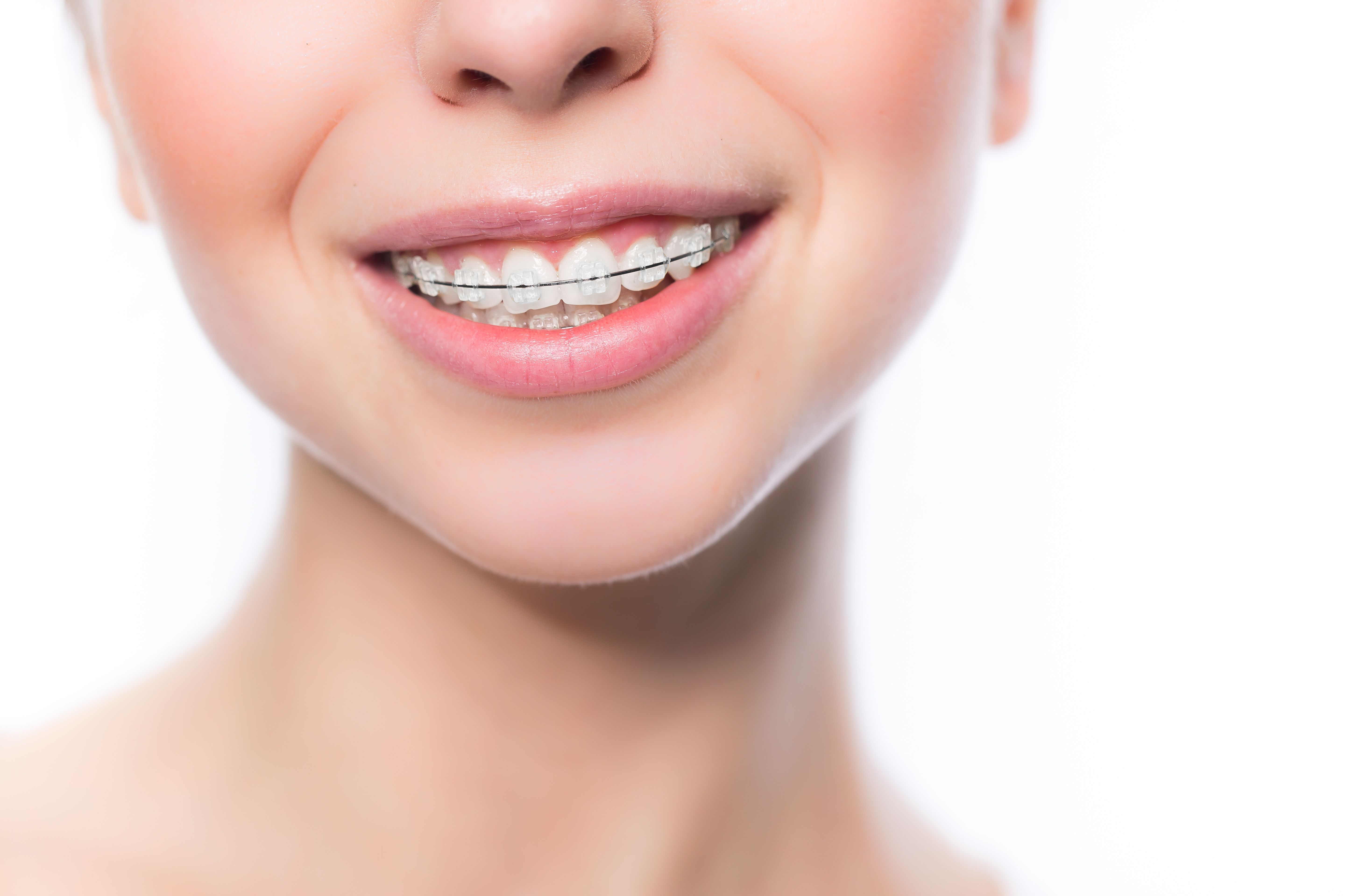 Ortodoncia invisible: Tratamientos de Clínica Dental Liliana Rinaldi Ortodoncia invisible: Tratamientos de Clínica Dental Liliana Rinaldi