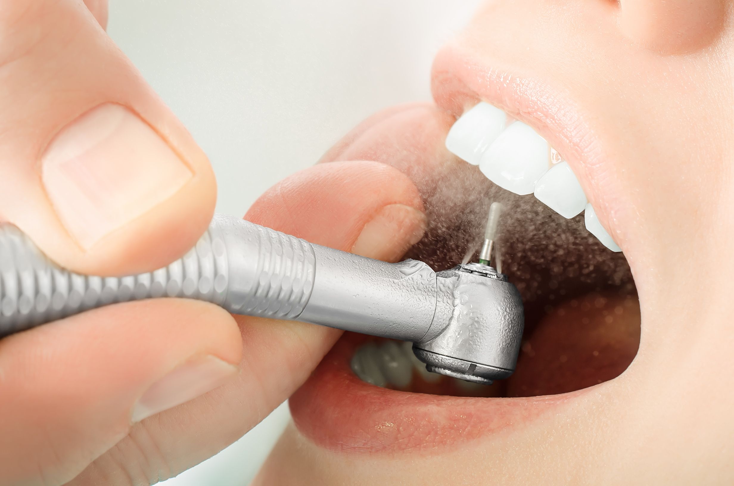 Periodoncia: Tratamientos de Clínica Dental Liliana Rinaldi Periodoncia: Tratamientos de Clínica Dental Liliana Rinaldi