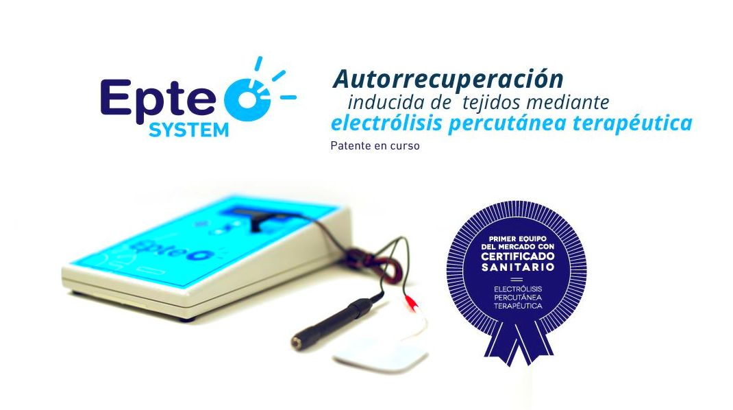 Electrolisis Percutanea Terapéutica EPTE (ECOGUIADA): Especialidades - Tratamientos de Clínica Nupofis Electrolisis Percutanea Terapéutica EPTE (ECOGUIADA): Especialidades - Tratamientos de Clínica Nupofis