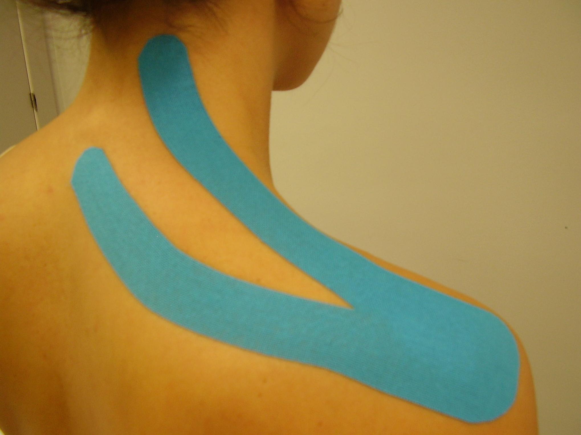 Vendaje Neuromuscular: Servicios de Sananova Fisioterapia Vendaje Neuromuscular: Servicios de Sananova Fisioterapia