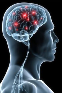 Fisioterapia Neurólogica: Servicios de Sananova Fisioterapia Fisioterapia Neurólogica: Servicios de Sananova Fisioterapia