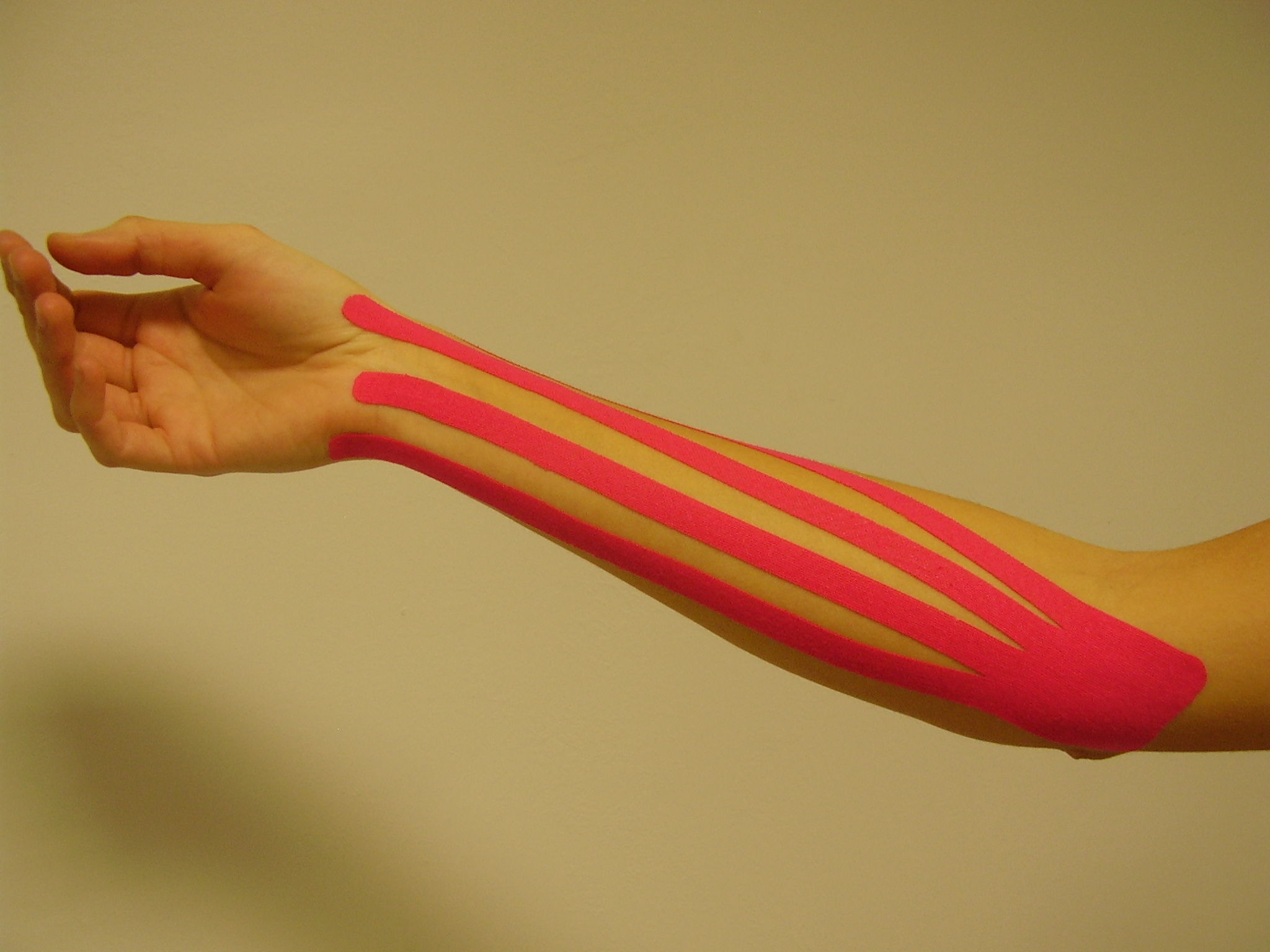 Vendaje Neuromuscular: Servicios de Sananova Fisioterapia Vendaje Neuromuscular: Servicios de Sananova Fisioterapia