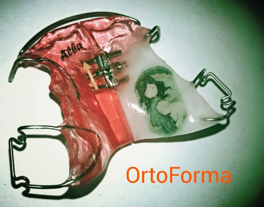 Foto 4 de Laboratorio de ortodoncia en  | Ortoforma
