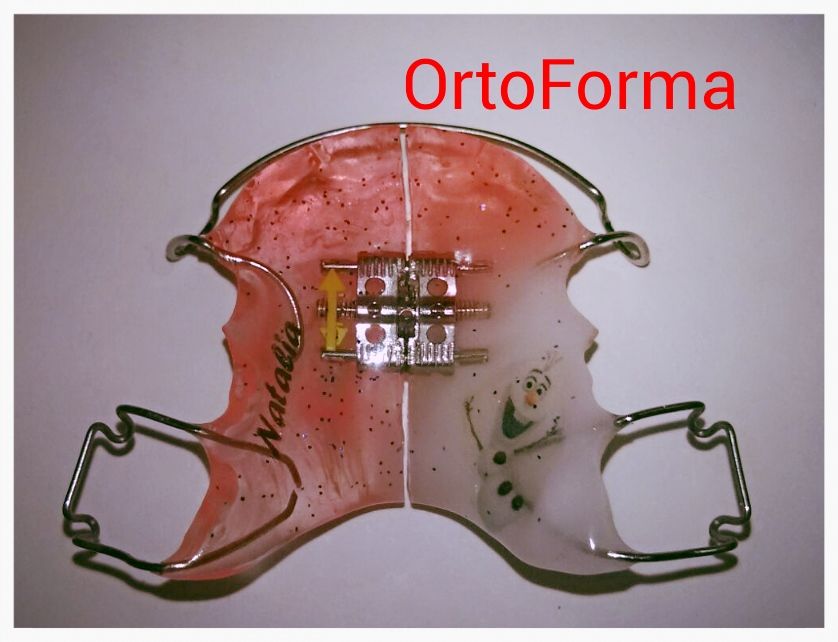 Foto 6 de Laboratorio de ortodoncia en  | Ortoforma