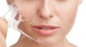 Peeling químico: Tratamientos y cosméticos de Etherma Peeling químico: Tratamientos y cosméticos de Etherma