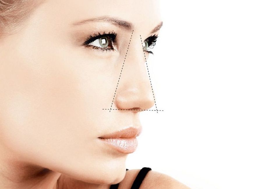 RINOPLASTIA: Cirugías habituales de Dr. Agustín Ballesteros RINOPLASTIA: Cirugías habituales de Dr. Agustín Ballesteros