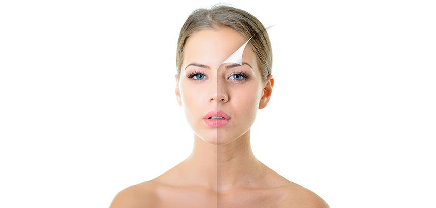 LIFTING FACIAL: Cirugías habituales de Dr. Agustín Ballesteros - Cirujano Plástico LIFTING FACIAL: Cirugías habituales de Dr. Agustín Ballesteros - Cirujano Plástico