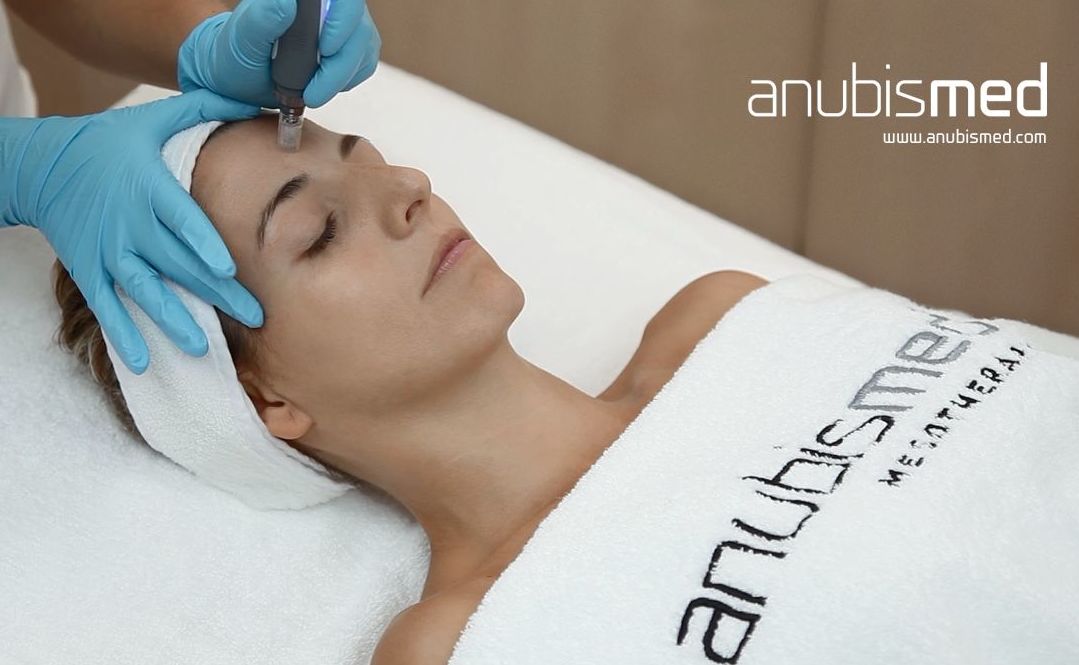 Terapia de inducción de colágeno: Tratamientos de Alegría Spa Catalonia Reina Victoria**** Terapia de inducción de colágeno: Tratamientos de Alegría Spa Catalonia Reina Victoria****