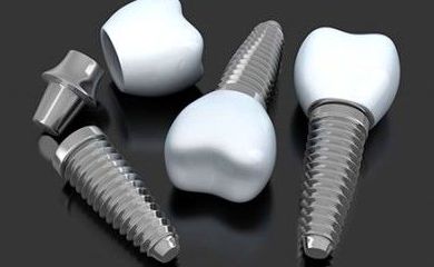 implante de dientes en Palamós