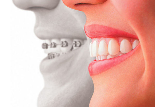 Ortodoncia: Tratamientos de Clínica Dental Presencia Ortodoncia: Tratamientos de Clínica Dental Presencia
