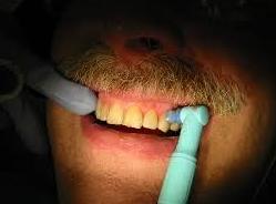 Blanqueamiento dental: Servicios de Vicálvaro Dental - Clínica Dental Blanqueamiento dental: Servicios de Vicálvaro Dental - Clínica Dental