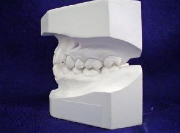 Brackets estéticos: Servicios de Vicálvaro Dental - Clínica Dental Brackets estéticos: Servicios de Vicálvaro Dental - Clínica Dental