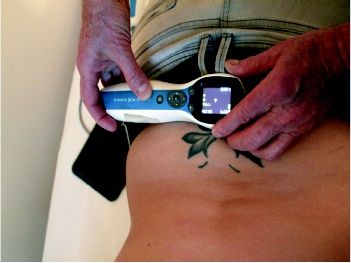 Tratamiento para el dolor en Tenerife con Neuroestimulador InterX Tratamiento para el dolor en Tenerife con Neuroestimulador InterX