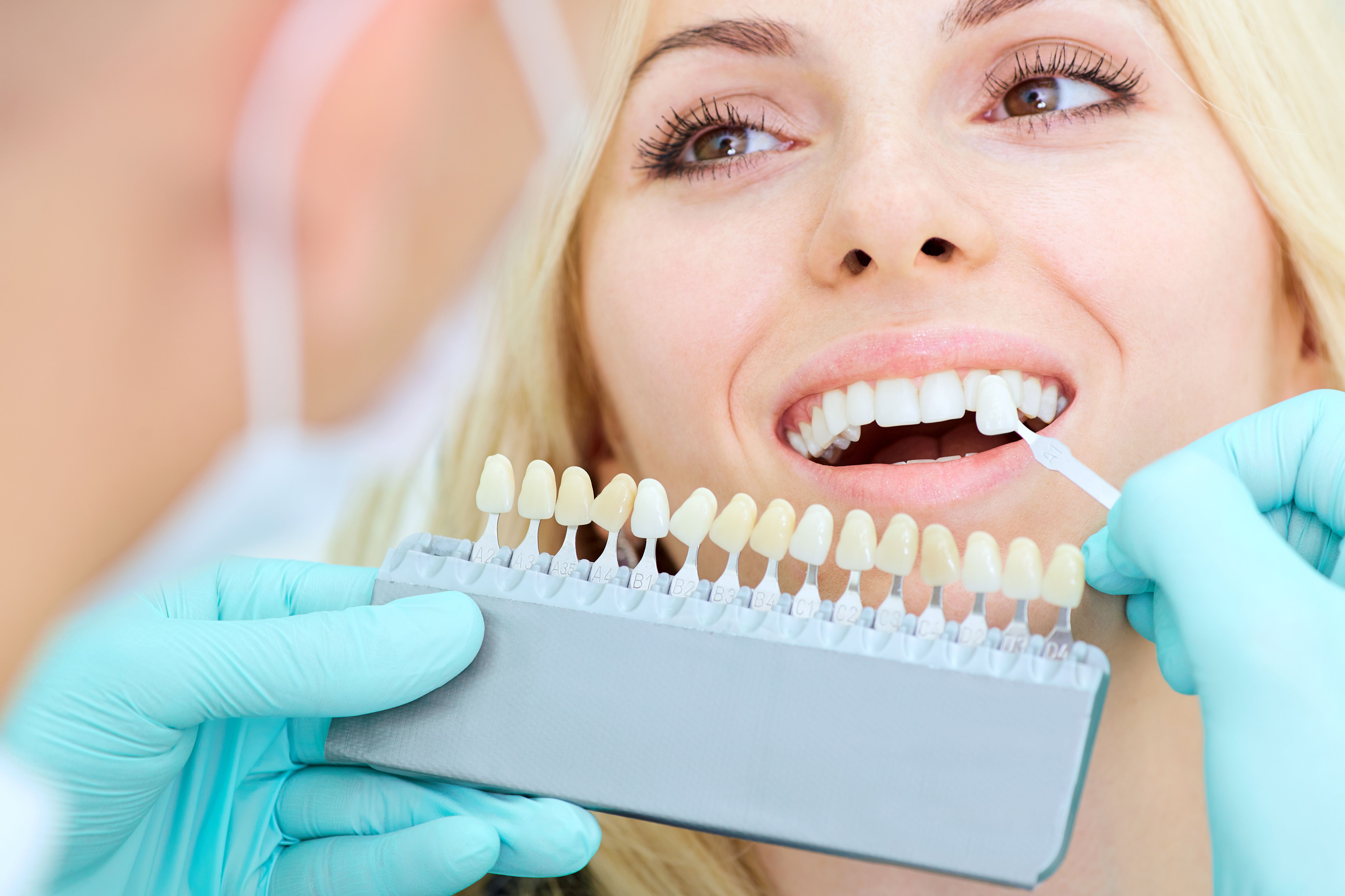 Estética dental: Tratamientos dentales de Dr. Joaquín Artigas Estética dental: Tratamientos dentales de Dr. Joaquín Artigas