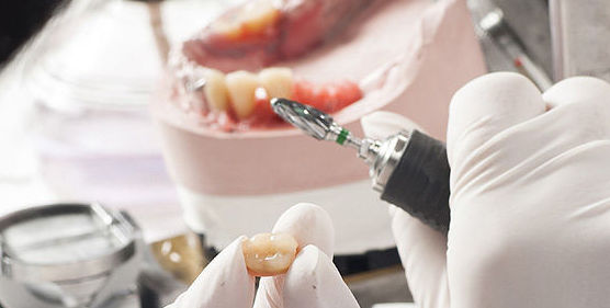 Prótesis dental removible: Servicios de Centro Dental Integral Mª Azucena Plata Vega Prótesis dental removible: Servicios de Centro Dental Integral Mª Azucena Plata Vega