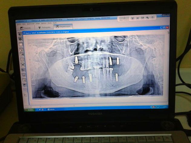 Digitalización radiografias: Servicios de Centro Dental Integral Mª Azucena Plata Vega Digitalización radiografias: Servicios de Centro Dental Integral Mª Azucena Plata Vega