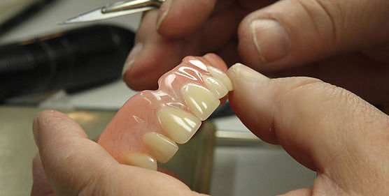 Prótesis dental fija cerámica sin metal: Servicios de Centro Dental Integral Mª Azucena Plata Vega Prótesis dental fija cerámica sin metal: Servicios de Centro Dental Integral Mª Azucena Plata Vega