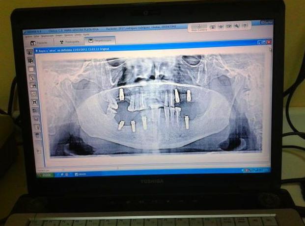 Panorex dental: Servicios de Centro Dental Integral Mª Azucena Plata Vega Panorex dental: Servicios de Centro Dental Integral Mª Azucena Plata Vega