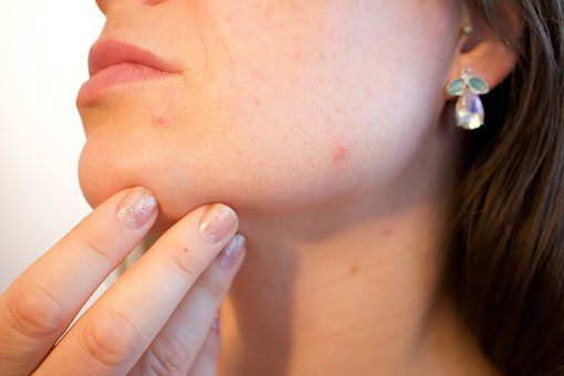 Acné: Dermatología y Dermoestética de Dermatología Socorro Fierro Acné: Dermatología y Dermoestética de Dermatología Socorro Fierro