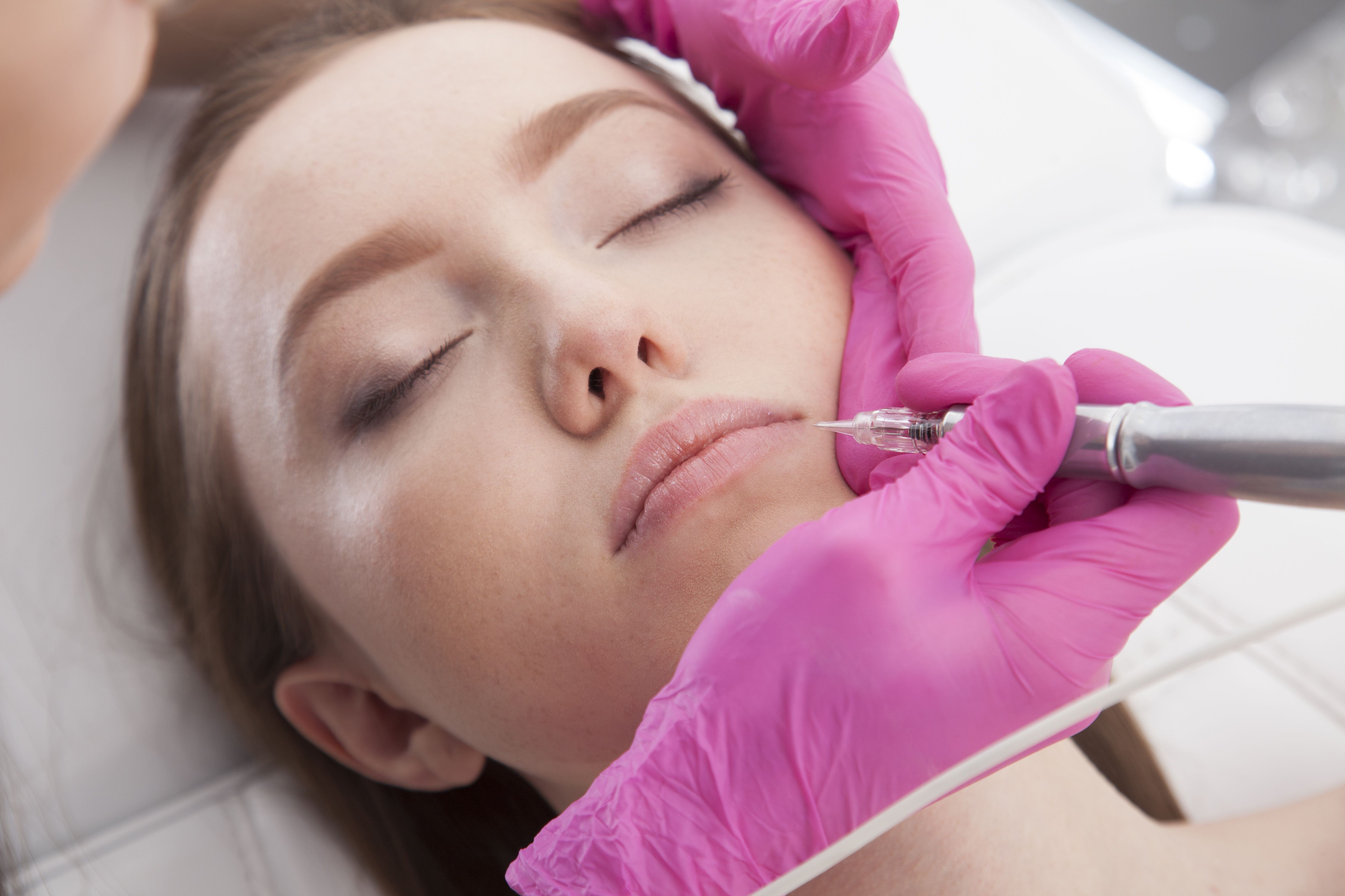 Relleno de Ácido Hialurónico: Dermatología y Dermoestética de Dermatología Socorro Fierro Relleno de Ácido Hialurónico: Dermatología y Dermoestética de Dermatología Socorro Fierro