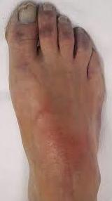 Uñas: Dermatología y Dermoestética de Dermatología Socorro Fierro Uñas: Dermatología y Dermoestética de Dermatología Socorro Fierro