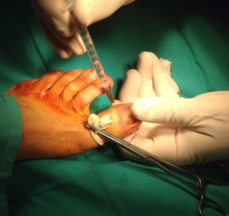 Uñas: Dermatología y Dermoestética de Dermatología Socorro Fierro Uñas: Dermatología y Dermoestética de Dermatología Socorro Fierro