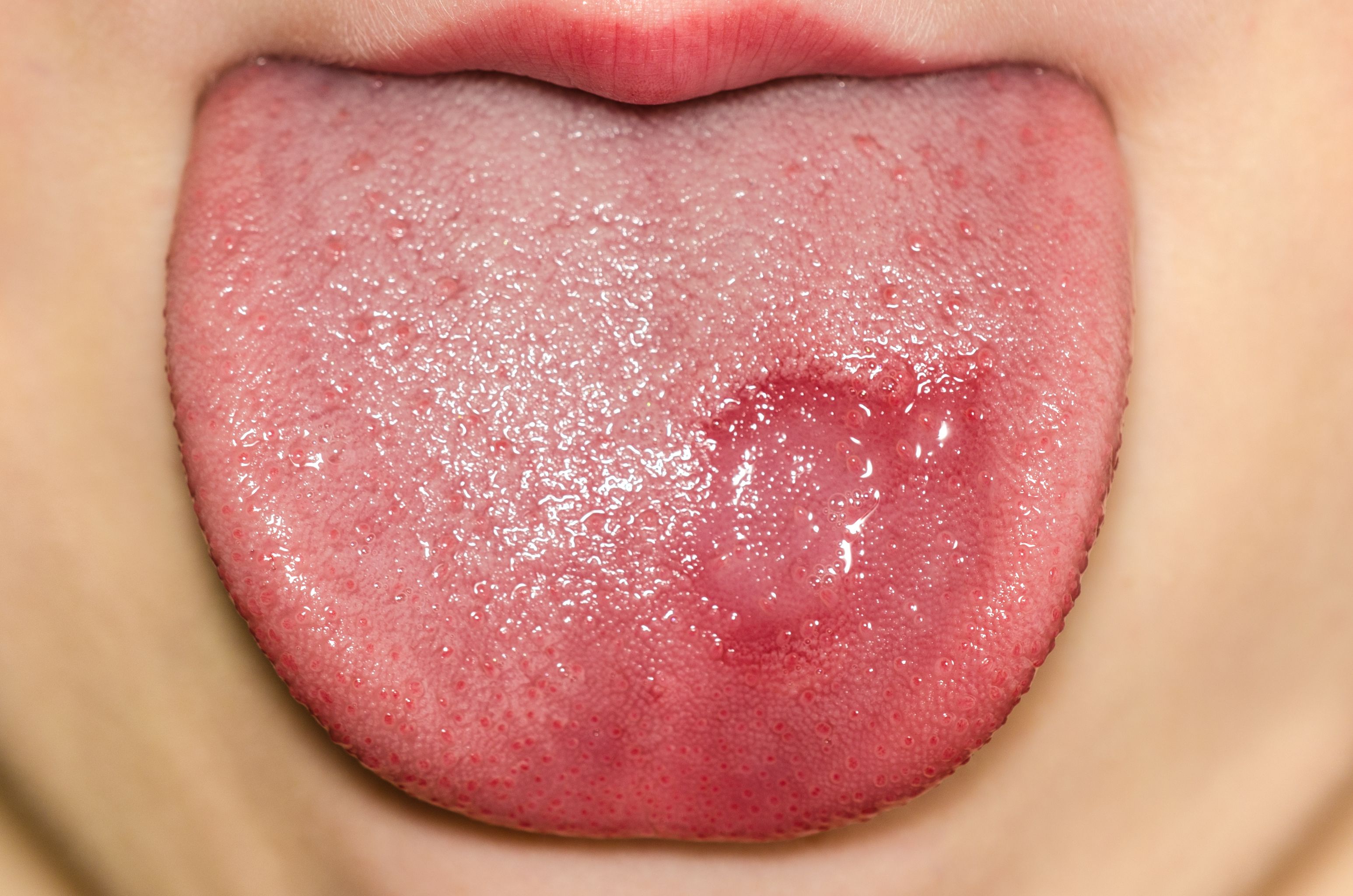 Patología de las mucosas: Dermatología y Dermoestética de Dermatología Socorro Fierro Patología de las mucosas: Dermatología y Dermoestética de Dermatología Socorro Fierro