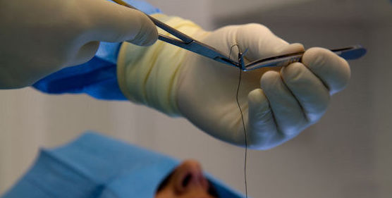 Cirugía bucal : Tratamientos de Clínica Dental Center