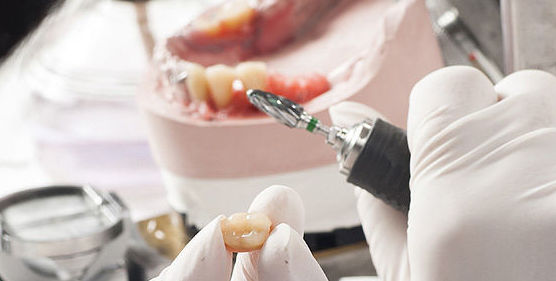 Prótesis : Tratamientos de Clínica Dental Center