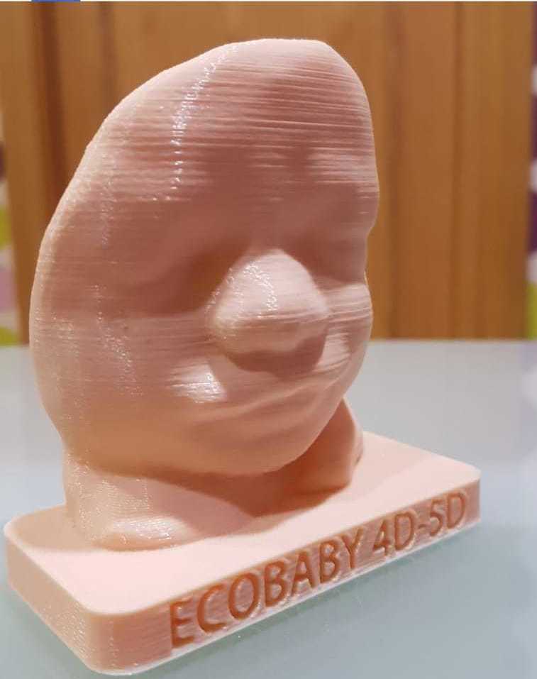 IMPRESION 3D DE ECOGRAFIAS : Servicios de ECOBABY 4D/5D Tel. 661 32 12 56 IMPRESION 3D DE ECOGRAFIAS : Servicios de ECOBABY 4D/5D Tel. 661 32 12 56