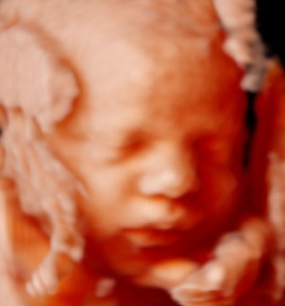 PACK 3 ECOGRAFIAS 5D HQ. LIGHTVISION 130€: Servicios de ECOBABY 4D/5D Tel. 661 32 12 56 PACK 3 ECOGRAFIAS 5D HQ. LIGHTVISION 130€: Servicios de ECOBABY 4D/5D Tel. 661 32 12 56