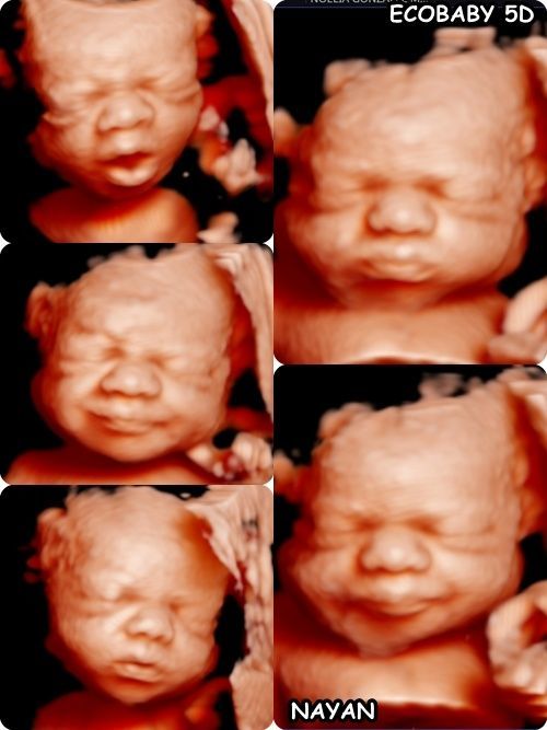 ECO 5D + IMPRESION 3D : Servicios de ECOBABY 4D/5D Tel. 661 32 12 56 ECO 5D + IMPRESION 3D : Servicios de ECOBABY 4D/5D Tel. 661 32 12 56