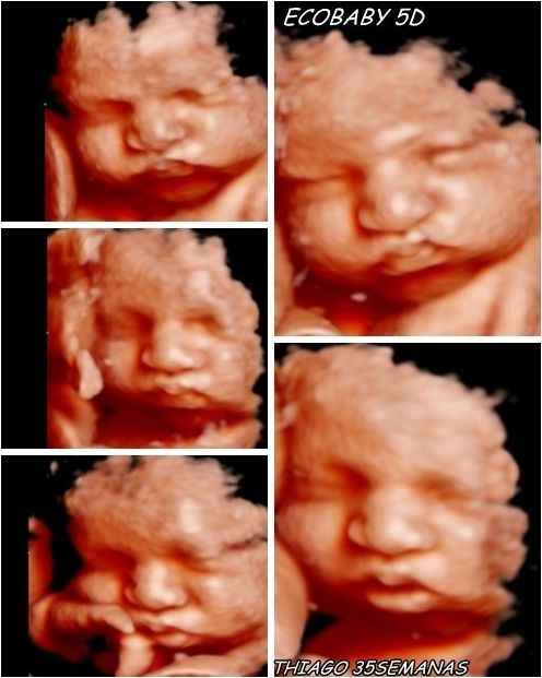 PROMOCION ECO 5D+SESION DE FOTOS EMBARAZO : Servicios de ECOBABY 4D/5D Tel. 661 32 12 56 PROMOCION ECO 5D+SESION DE FOTOS EMBARAZO : Servicios de ECOBABY 4D/5D Tel. 661 32 12 56