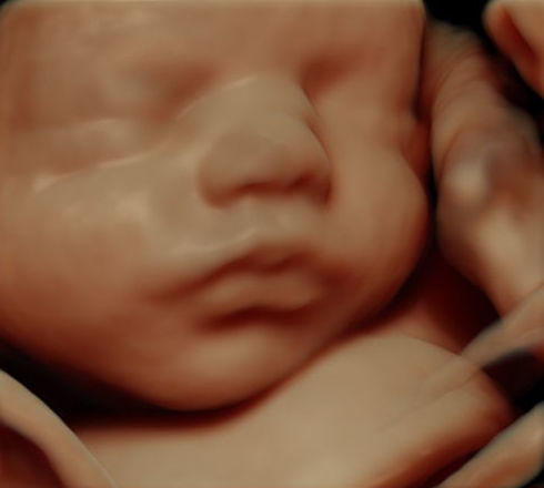 ECO 5D HQ LIGHTVISION : Servicios de ECOBABY 4D/5D Tel. 661 32 12 56 ECO 5D HQ LIGHTVISION : Servicios de ECOBABY 4D/5D Tel. 661 32 12 56