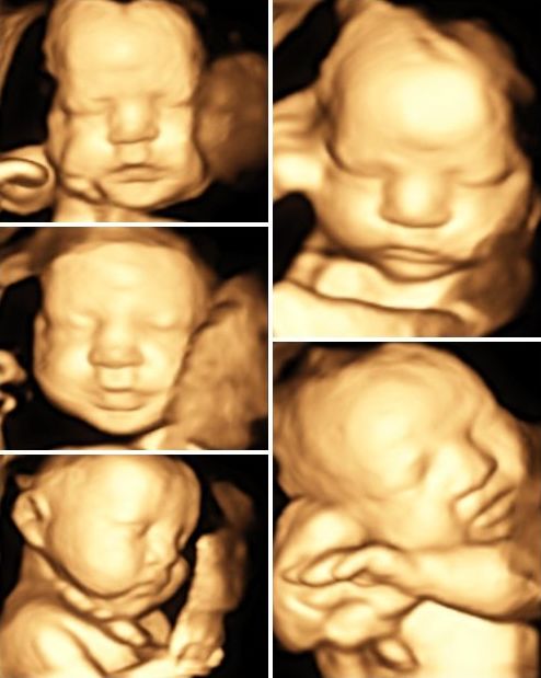 PROMOCIÓN INVIERNO ECO 4D : Servicios de ECOBABY 4D/5D Tel. 661 32 12 56 PROMOCIÓN INVIERNO ECO 4D : Servicios de ECOBABY 4D/5D Tel. 661 32 12 56