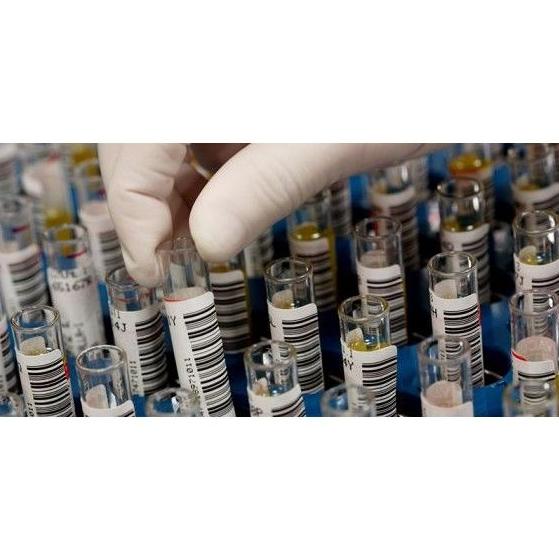 Muestras de Esputo: Servicios de Laboratorio Valenzuela Muestras de Esputo: Servicios de Laboratorio Valenzuela