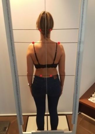 Examen Postural: Síntomas y Problemas de Quiropràctic Manresa Examen Postural: Síntomas y Problemas de Quiropràctic Manresa