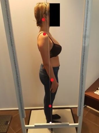 Examen Postural: Síntomas y Problemas de Quiropràctic Manresa Examen Postural: Síntomas y Problemas de Quiropràctic Manresa