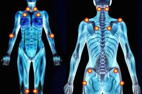 Fibromialgia: Síntomas y Problemas de Quiropràctic Manresa Fibromialgia: Síntomas y Problemas de Quiropràctic Manresa