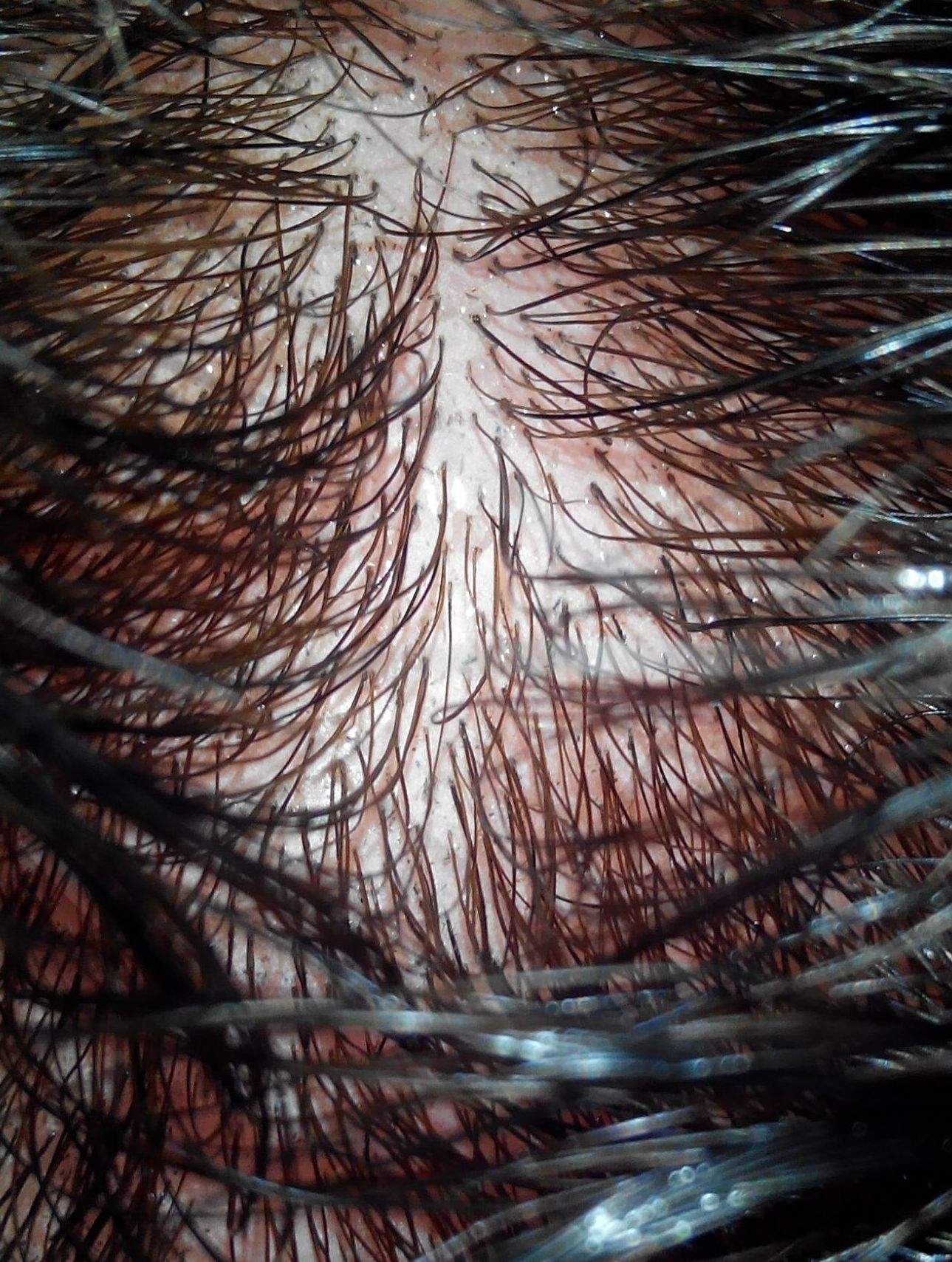 1A. Silicona Inyectada Ultrafina , Topline : Catálogo Prótesis Capilares de Estudio Capilar 1A. Silicona Inyectada Ultrafina , Topline : Catálogo Prótesis Capilares de Estudio Capilar