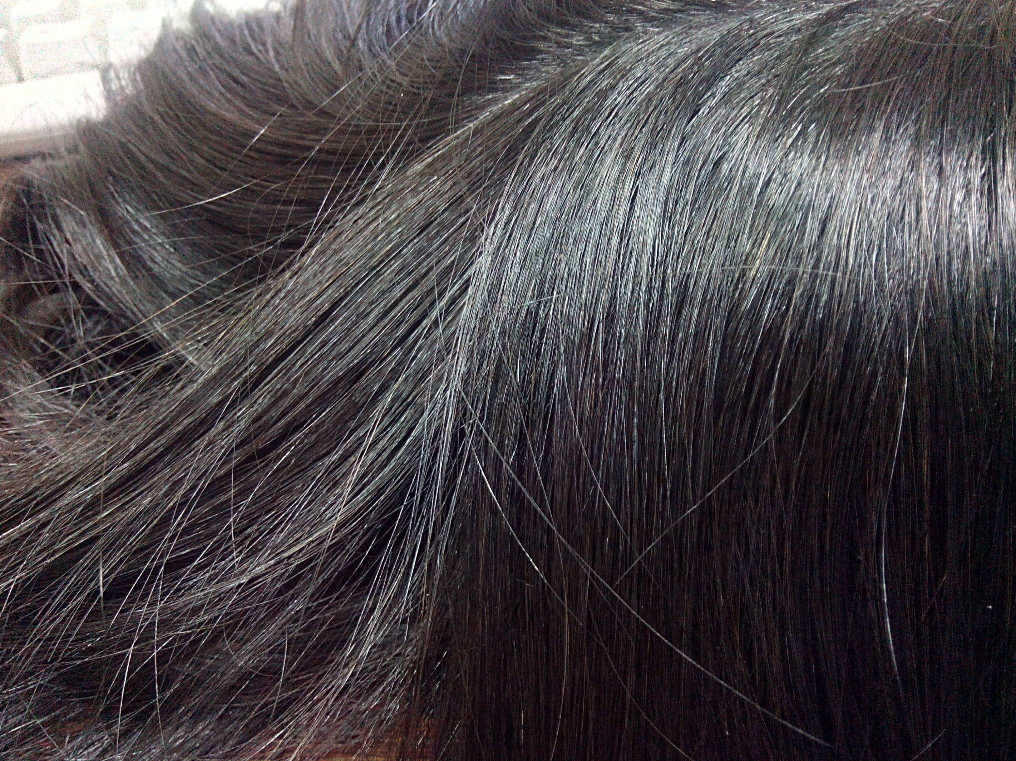 1. Skin Inyectada, Euro.Virg.: Catálogo Prótesis Capilares de Estudio Capilar 1. Skin Inyectada, Euro.Virg.: Catálogo Prótesis Capilares de Estudio Capilar
