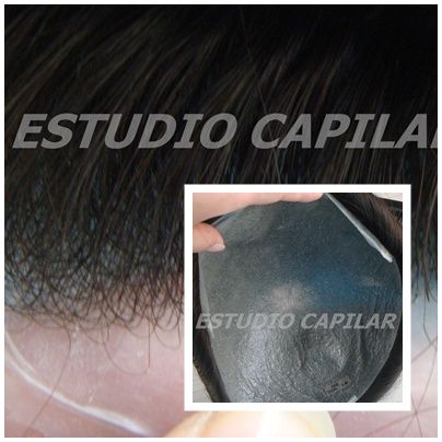 1. SKIN 0,02mm - EUROPEO REMY: Catálogo Prótesis Capilares de Estudio Capilar 1. SKIN 0,02mm - EUROPEO REMY: Catálogo Prótesis Capilares de Estudio Capilar