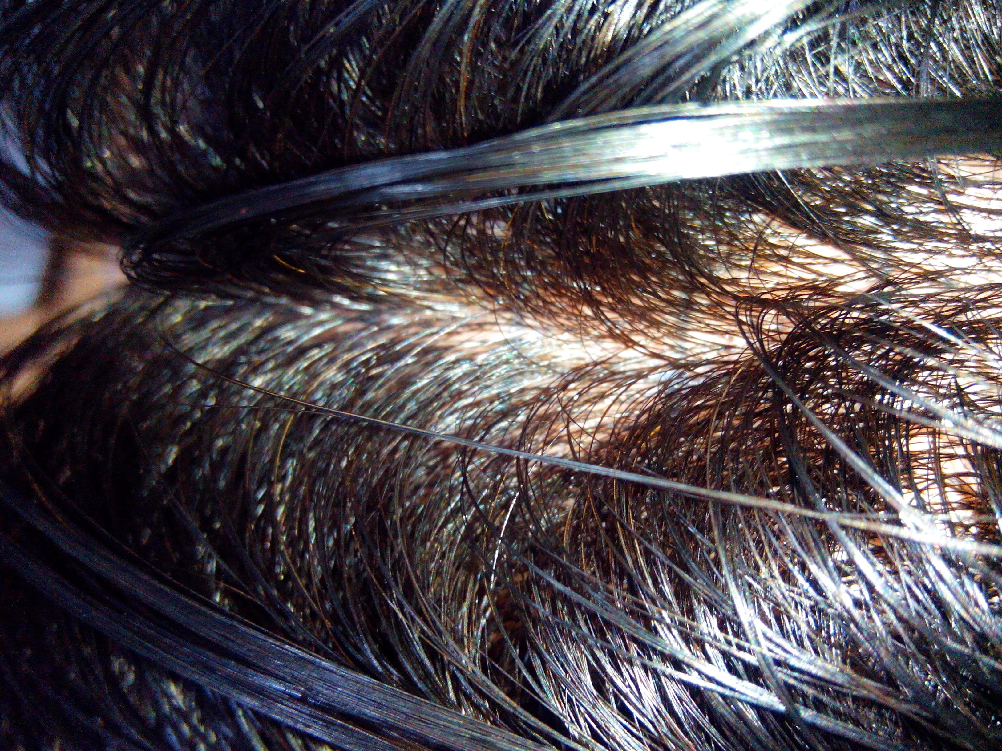 1. Skin Inyectada, Euro.Virg.: Catálogo Prótesis Capilares de Estudio Capilar 1. Skin Inyectada, Euro.Virg.: Catálogo Prótesis Capilares de Estudio Capilar