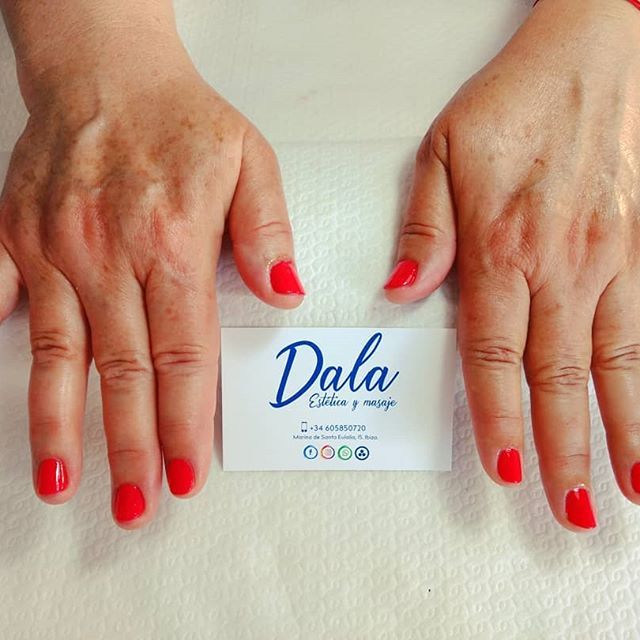 Estética / Beauty: Servicios de Dala Estética y Masaje Estética / Beauty: Servicios de Dala Estética y Masaje