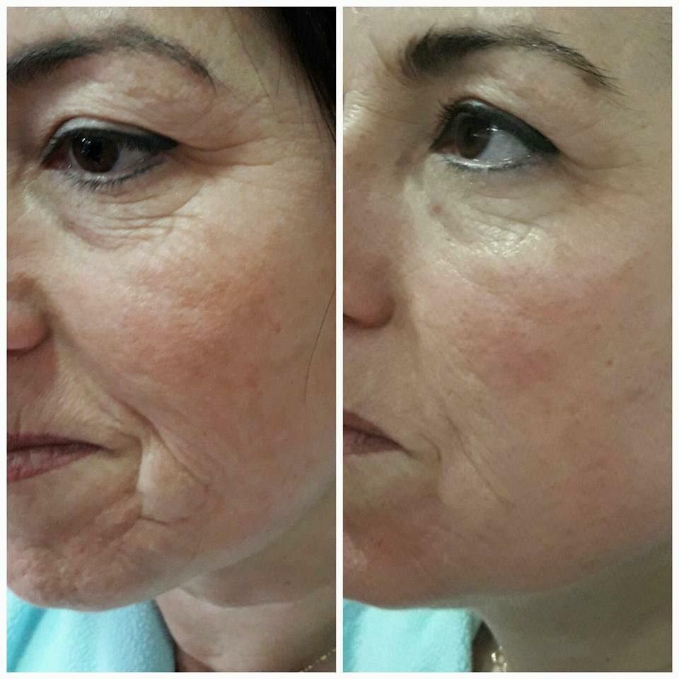 Cuidado y rejuvenecimiento facial: Servicios de Centro médico Paqui López Cuidado y rejuvenecimiento facial: Servicios de Centro médico Paqui López