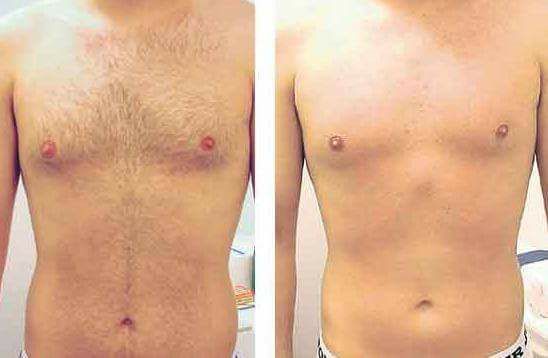 Depilación y bronceado: Servicios de Centro médico Paqui López Depilación y bronceado: Servicios de Centro médico Paqui López
