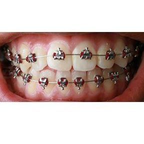 Ortodoncia: Tratamientos de Maribel Soto Vera - MS Dental }}