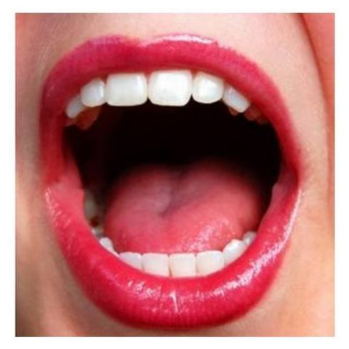 Estética dental: Tratamientos de Maribel Soto Vera - MS Dental
